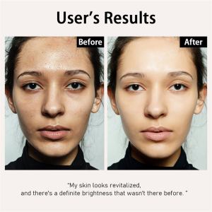 Before and after skin rejuvenation